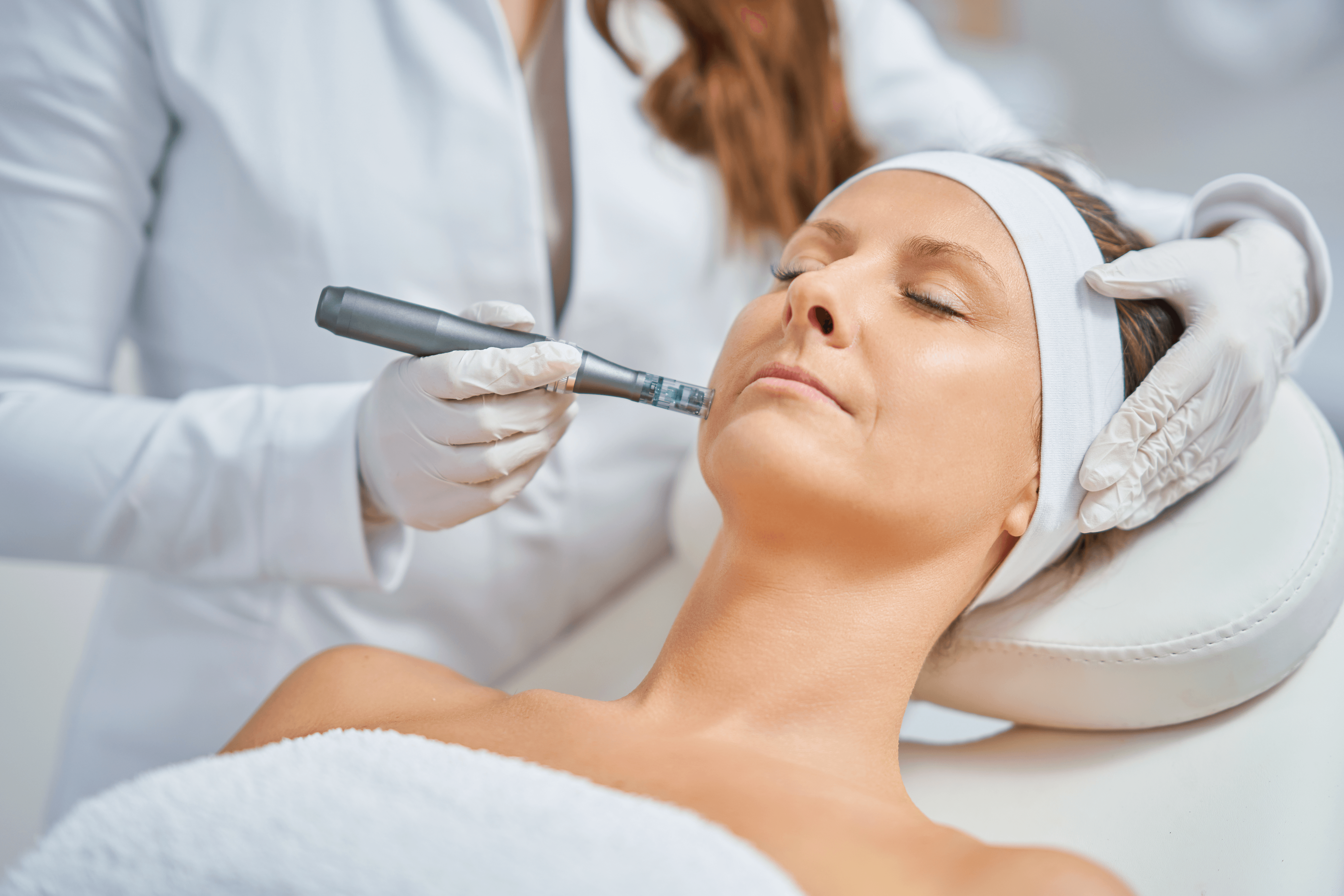 Microneedling